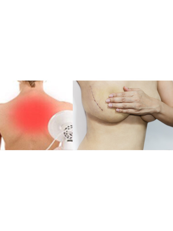 Płyn przyspieszający gojenie ran ze srebrem Cerasept+ 500 ml