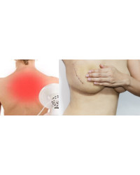 Płyn Po Radioterapii i Mastektomii Cerasept + Antybakteryjny 100ml