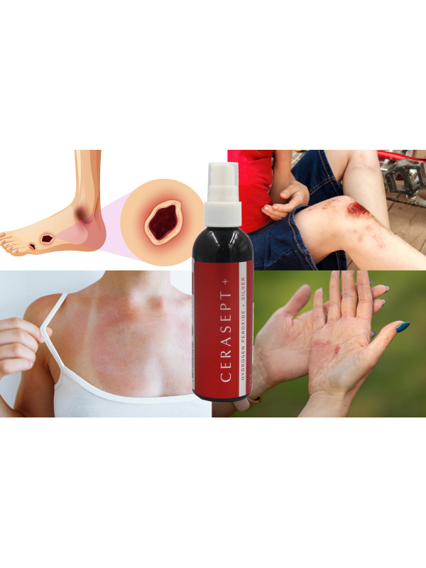 Płyn Po Radioterapii i Mastektomii Cerasept + Antybakteryjny 100ml