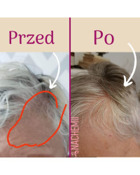 Serum stymulujące na porost włosów po chemioterapii Nachemii 100 ml