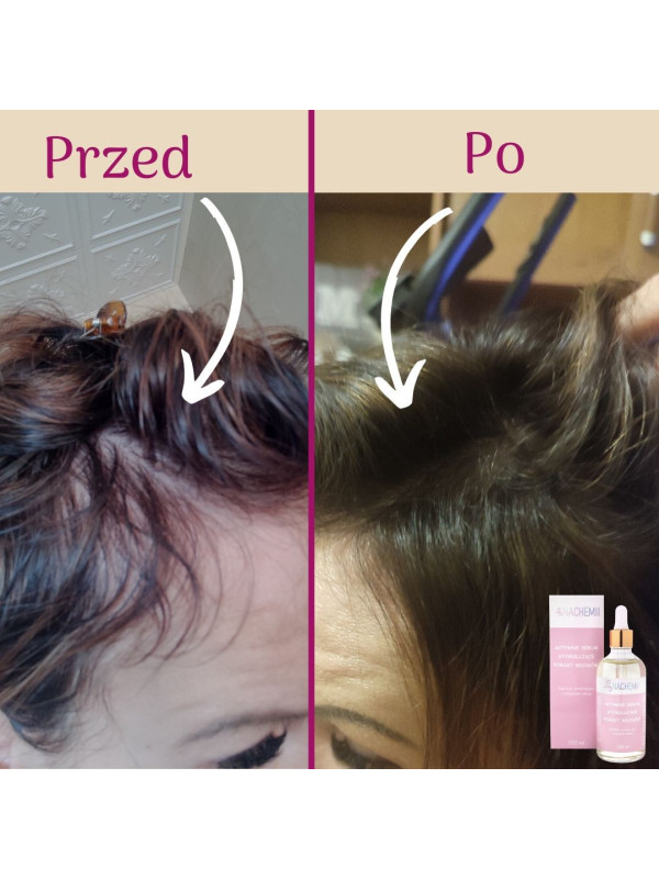 Serum stymulujące na porost włosów po chemioterapii Nachemii 100 ml