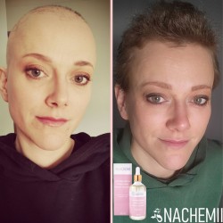 Serum stymulujące na porost włosów po chemioterapii Nachemii 100 ml