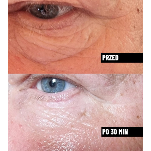 Serum do twarzy wygładzające przeciwzmarszczkowe Nachemii 30 ml