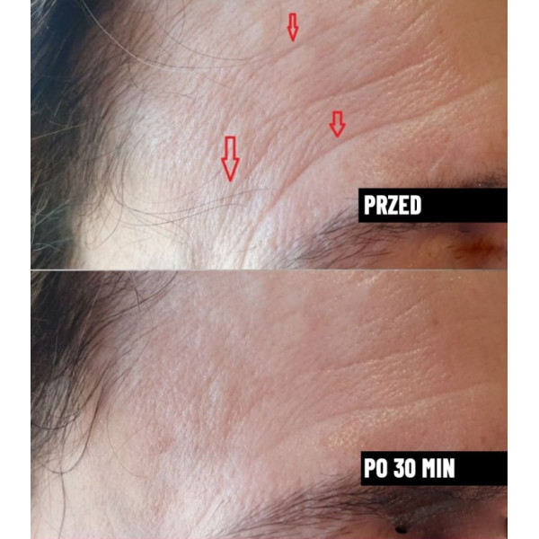 Serum do twarzy wygładzające przeciwzmarszczkowe Nachemii 30 ml