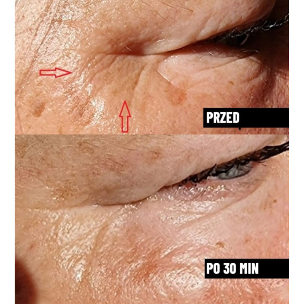 Serum do twarzy wygładzające przeciwzmarszczkowe Nachemii 30 ml